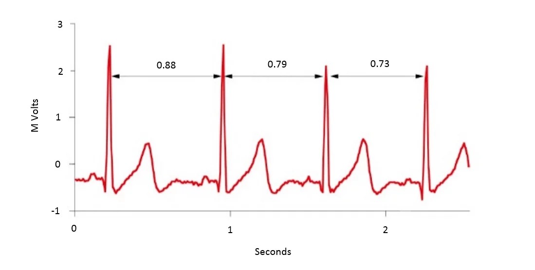 Variationen mellem forskellige hjerteslag kaldes hjerterytmevariabilitet (HRV).